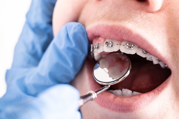 How A Braces Specialist Makes For A More Comfortable Treatment