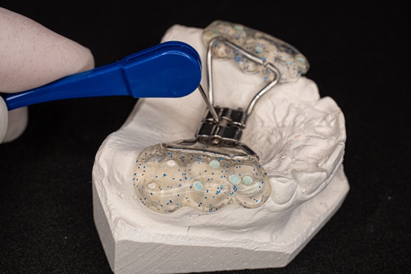 When And Why Expanders Are Recommended By Orthodontists